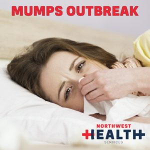 MUMPS OUTBREAK-01